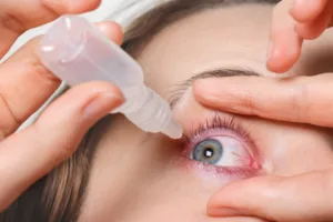 Riboflavin eye drop is used to treat Keratoconus.